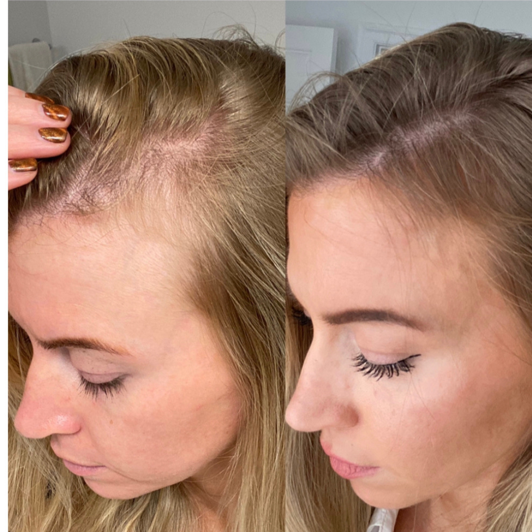 Alua Kollagenprotein